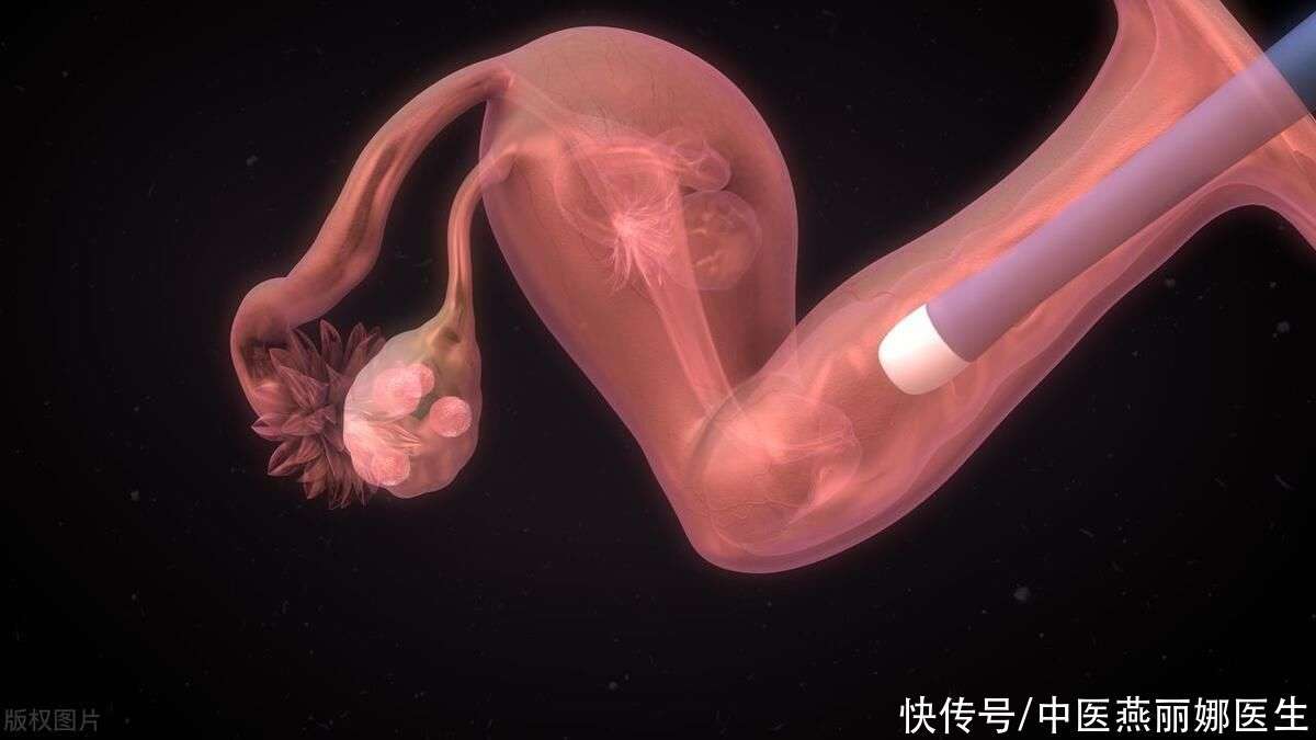 代孕补偿