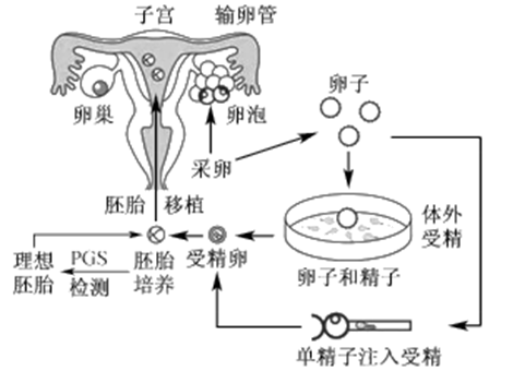 代孕费用