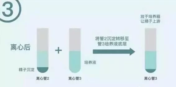 代孕费用