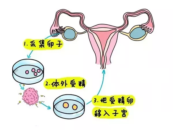 代孕