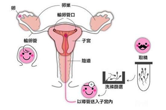 明星代孕