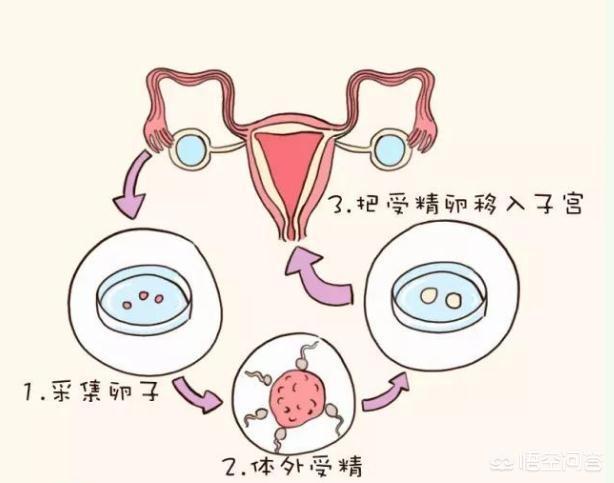 代孕因果
