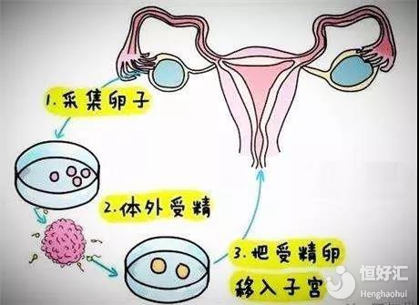 河北代妈补偿